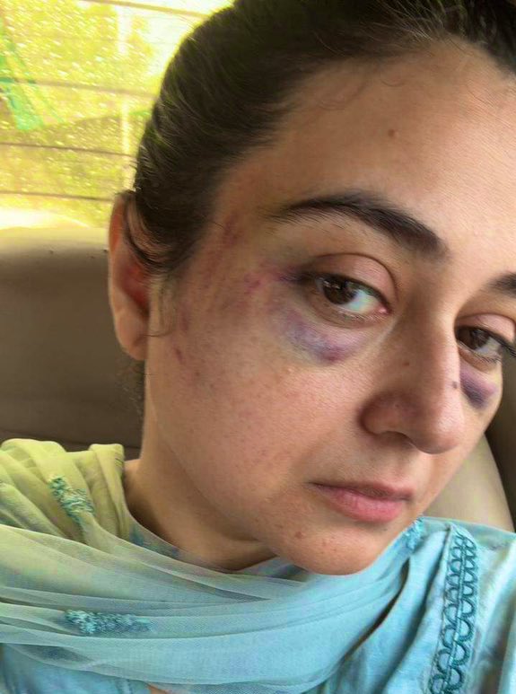 khukala_46's tweet photo. یہ تصویر ہمارے معاشرے میں پائے جانے والے ظلم و ستم کی عکاسی کرتی ہے۔ کسی بھی عورت پر اس قسم کا تشدد ناقابل قبول ہے۔ ہمیں مل کر اس ظلم کے خلاف آواز بلند کرنی چاہیے اور انصاف کی فراہمی کے لیے جدوجہد کرنی چاہیے۔ #عورت_کے_حقوق #خواتین_کا_تحفظ #ظلم_کے_خلاف #انصاف https://t.co/0vUd12sLmh