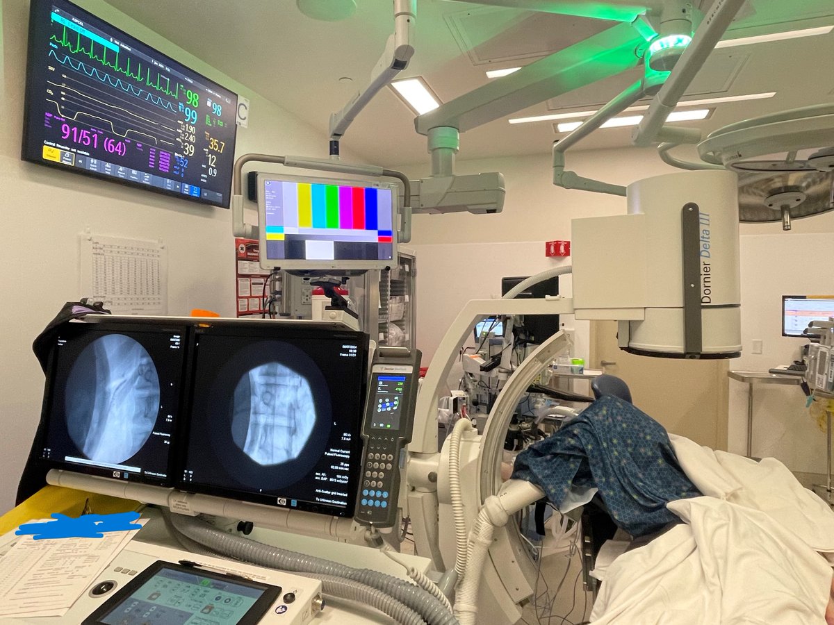 CincyKidsIntEC's tweet photo. We are happy to add a new procedure at @CincyChildrens for #pediatrics. ESWL(extracorporeal shock wave lithotripsy) can break up large #pancreas stones that are not accessible by #ERCP. We performed our 1st case successfully &amp; will continue to offer ESWL at CCHMC! @cincykidspcc https://t.co/SmO0au1lV6