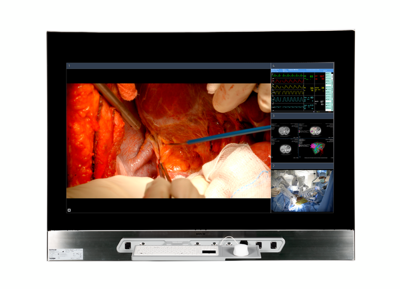 BarcoHealth's tweet image. Discover our #surgicaldisplays in all shapes &amp;amp; sizes!
👉 barco.com/en/products/me…

✔️ From 22" to 55"
✔️ 2D or 3D
✔️ 4K or HD
✔️ Mountable or in-wall
✔️ With or without touchscreen
✔️ For the endoscopy room, interventional suite and hybrid OR