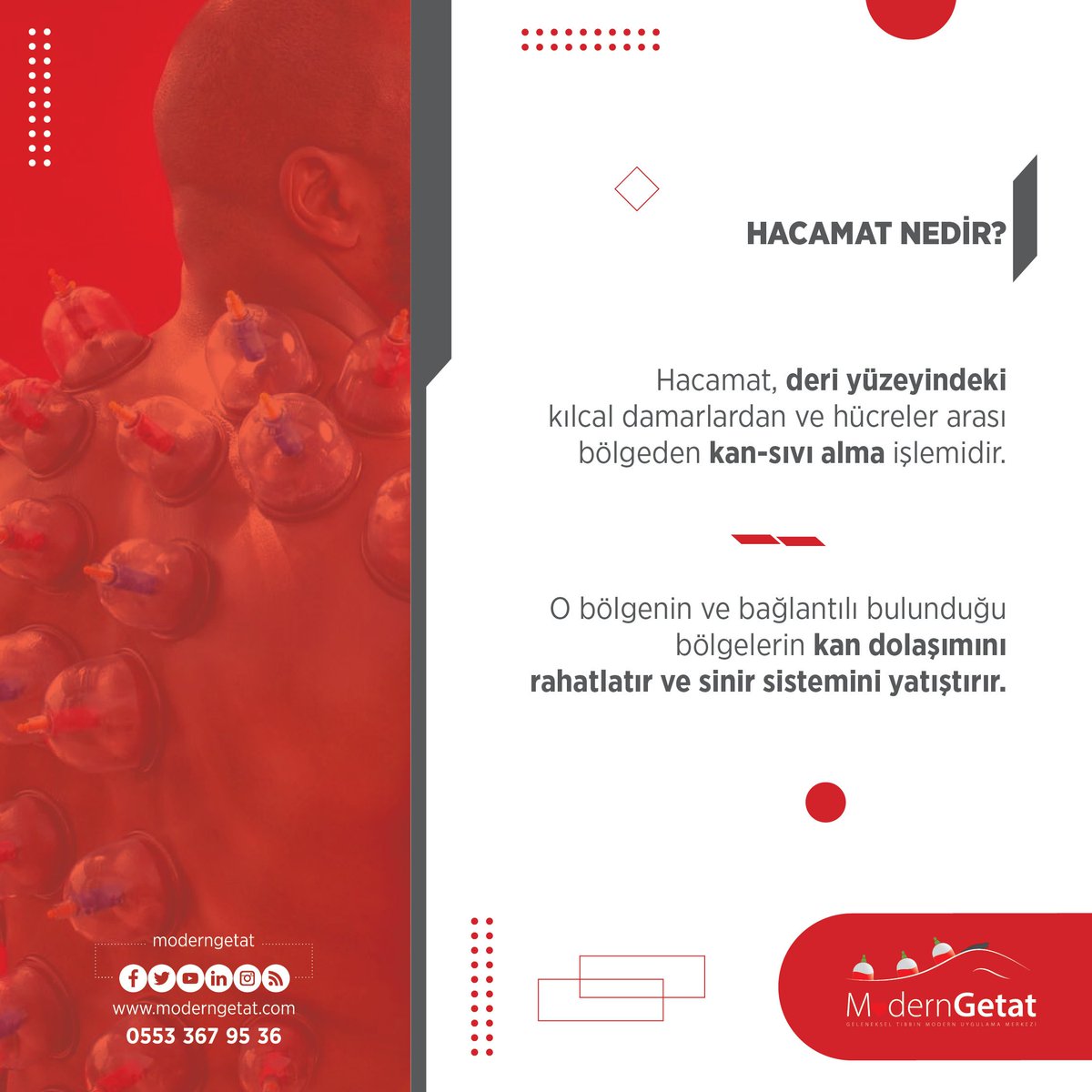 moderngetat's tweet photo. Hacamat Nedir?

Hacamat, deri yüzeyindeki kılcal damarlarda ve hücreler arası bölgeden kan-sıvı alma işlemidir.

O bölgenin ve bağlantılı bulunduğu bölgelerin kan dolaşımını rahatlatır ve sinir sistemini yatıştırır. https://t.co/o7gZ0ehbqU