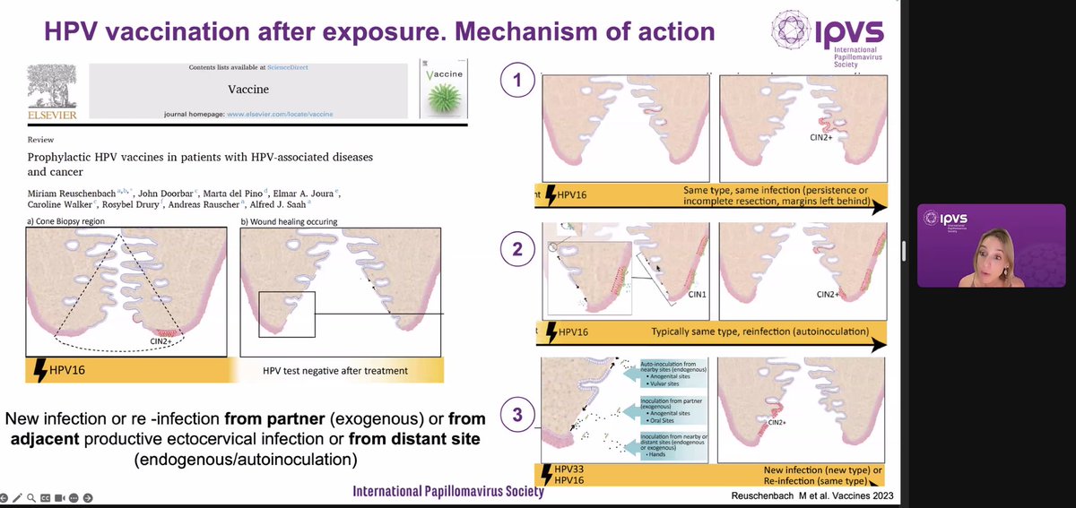 Fantástico webinar de la <a href="/IPVSociety/">IPVS - International Papillomavirus Society</a> sobre el uso de las #vacunas profilácticas frente a #VPH en la prevención de recurrencias.
Pronto conoceremos los resultados del estudio NOVEL, que aportará mayor evidencia al respecto.
Enhorabuena a los ponentes
¡Hemos aprendido y disfrutado!