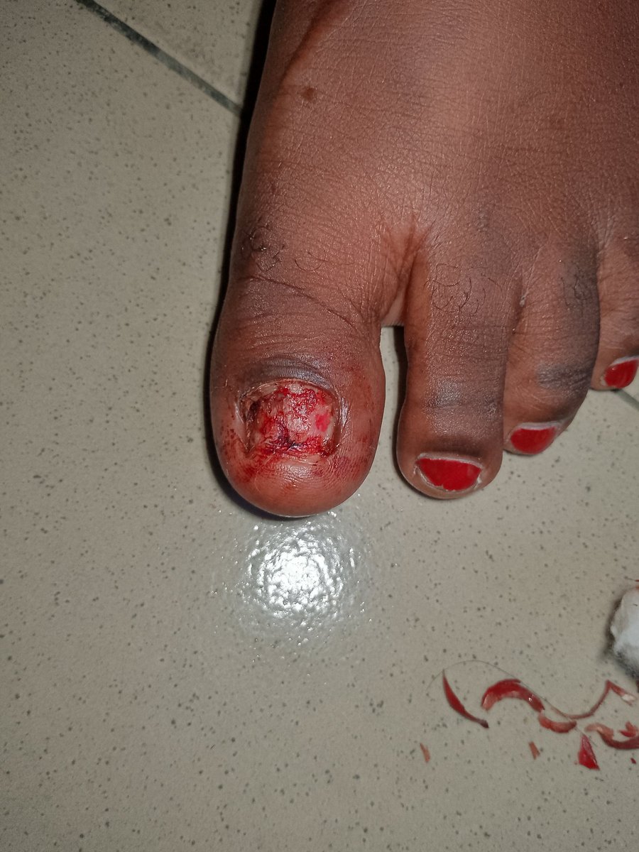 Dredds_expert's tweet photo. @inDrive  good evening,one of your driver who's name is MR Adekola  went away with my stuff and even went as far as reporting me to the police (Akobo division) I'm asked to report to the station tomorrow. Frame 1&amp;2 what your driver did to me before he zoomed off with my stuff https://t.co/pOauyrzCSy
