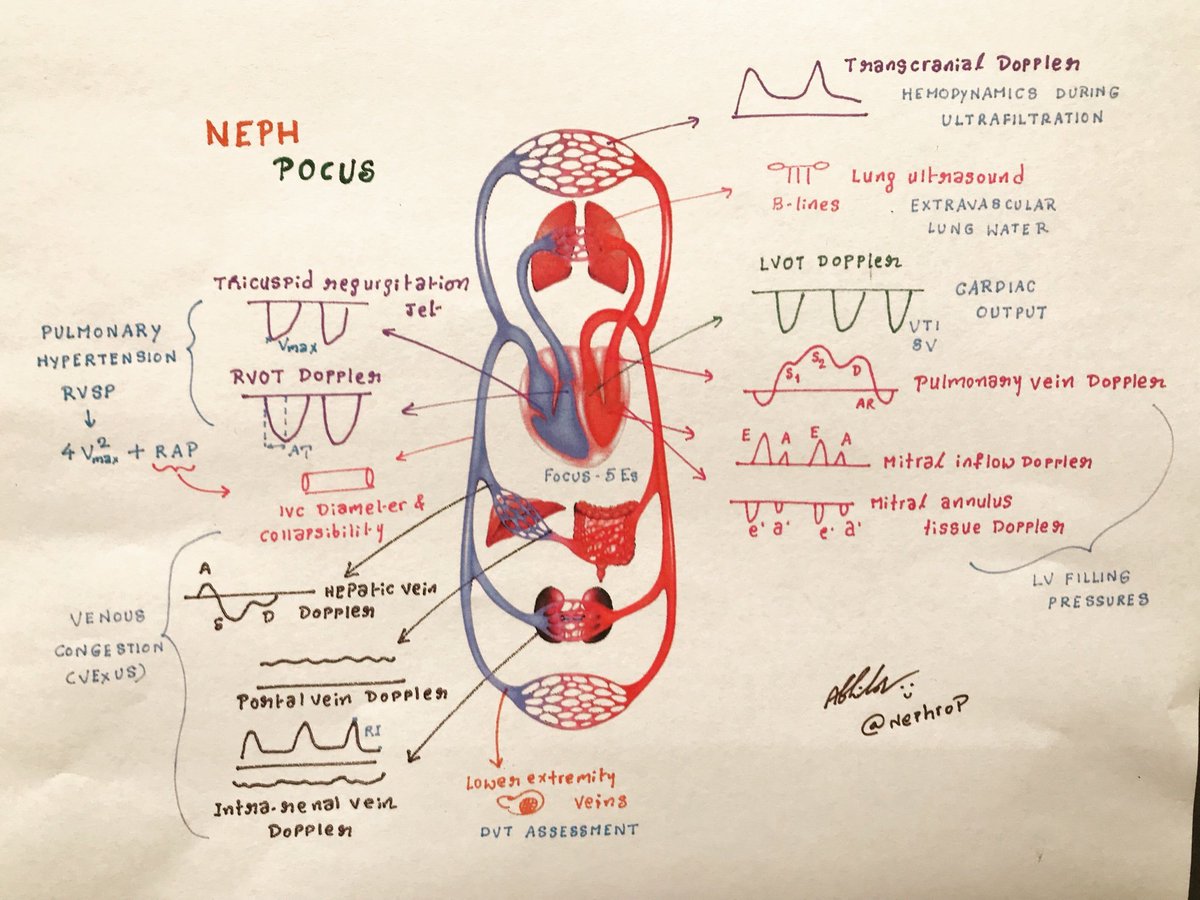 NephroP's tweet image. 6️⃣ Volume status assessment (more precisely, ‘hemodynamic’ assessment) involves evaluation of the whole hemodynamic circuit.
#POCUS #FOAMed