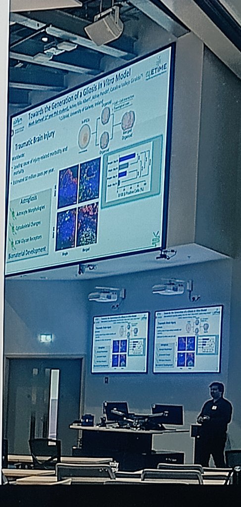catalinav78's tweet image. Great first flash talk by @Akash78Garhwal at #TCESxCDTs -  Exciting research on our assembloids work for gliosis models. #Science, #ResearchImpact