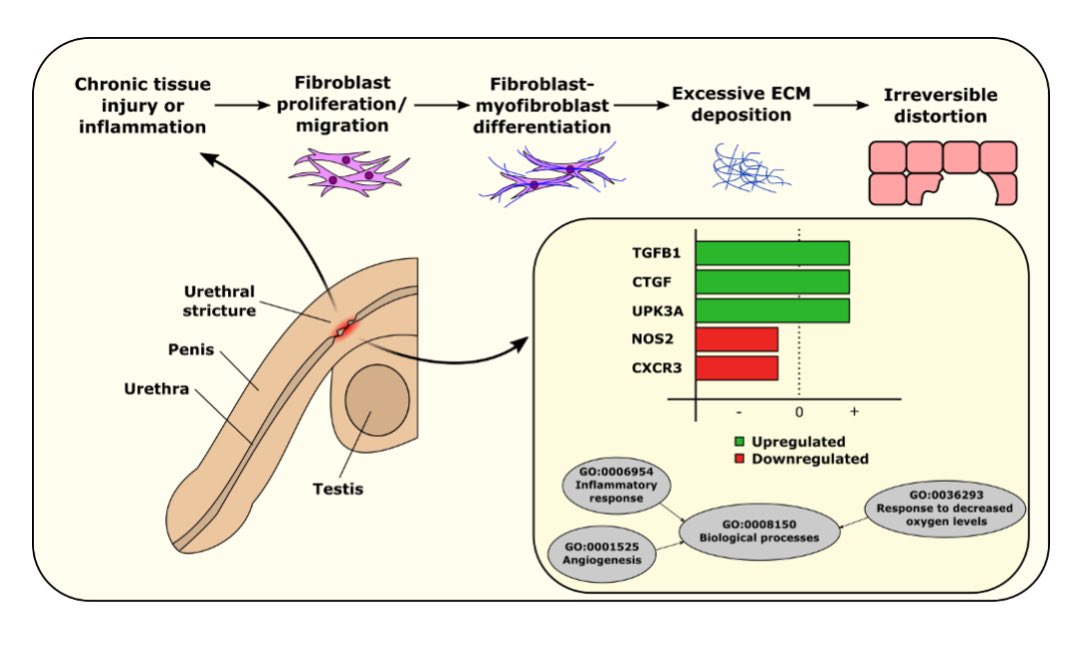 Ilaha Isali (@ilahaisali) on Twitter photo Our little commentary on genomic risk factors for urethral stricture <a href="/ben_breyer/">Benjamin Breyer</a> <a href="/Thomas_R_Wong/">Thomas Wong</a> <a href="/urotoday/">UroToday.com</a> ⏬⏬
urotoday.com/uij-archives/1… Our little commentary on genomic risk factors for urethral stricture <a href="/ben_breyer/">Benjamin Breyer</a> <a href="/Thomas_R_Wong/">Thomas Wong</a> <a href="/urotoday/">UroToday.com</a> ⏬⏬
urotoday.com/uij-archives/1…
