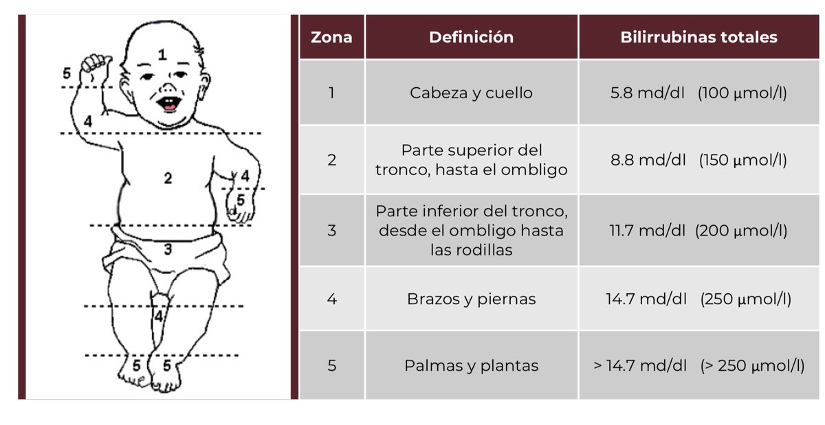 🌀   ESCALA  DE  KRAMER  PARA  EVALUAR  ICTERICIA  NEONATAL  

#ENARM #ENARM2024 #ENARM_INTENSIVO
