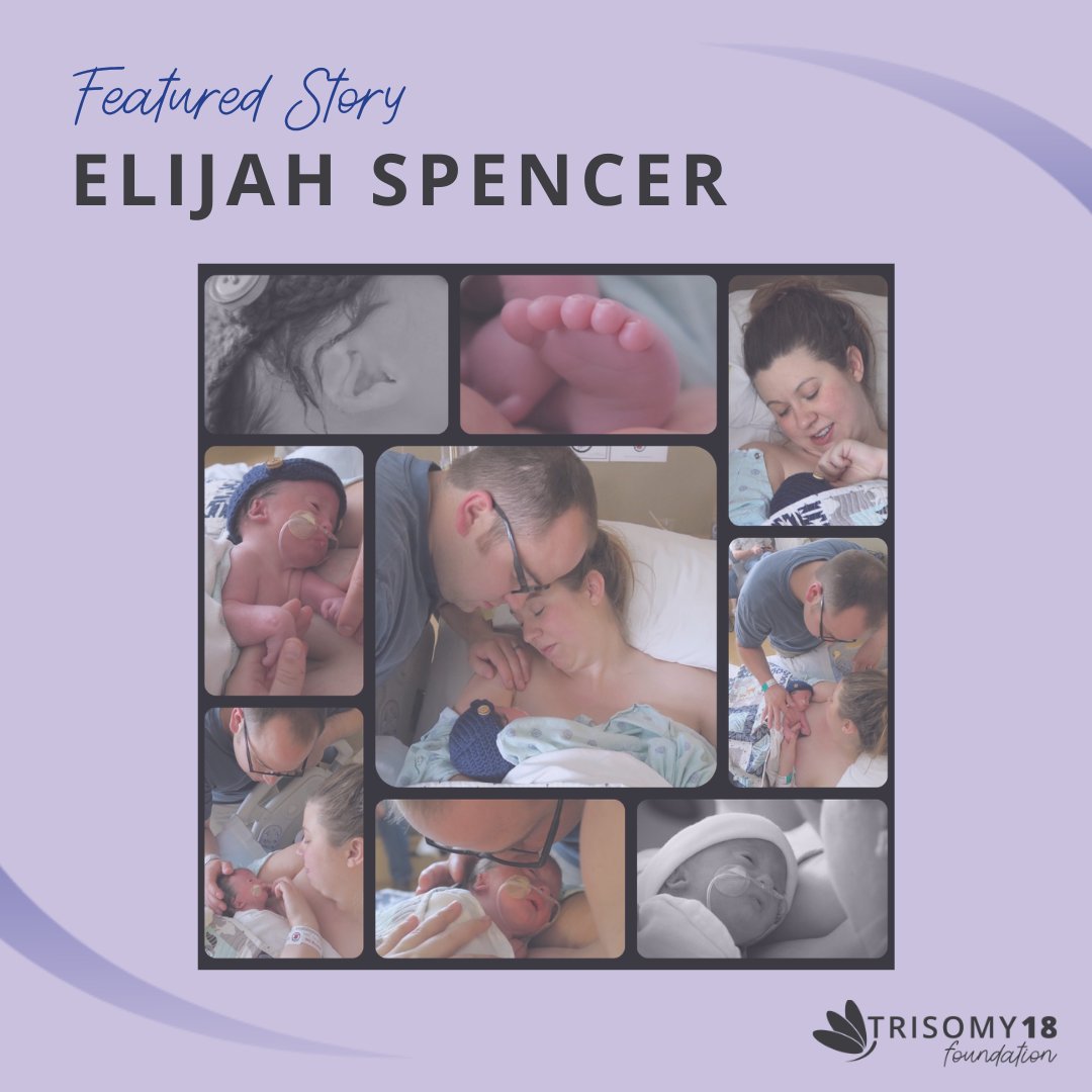 A mom shares how her faith in the promise of resurrection has helped her cope with the loss of her dear son.

trisomy18.org/story/elijah-s…