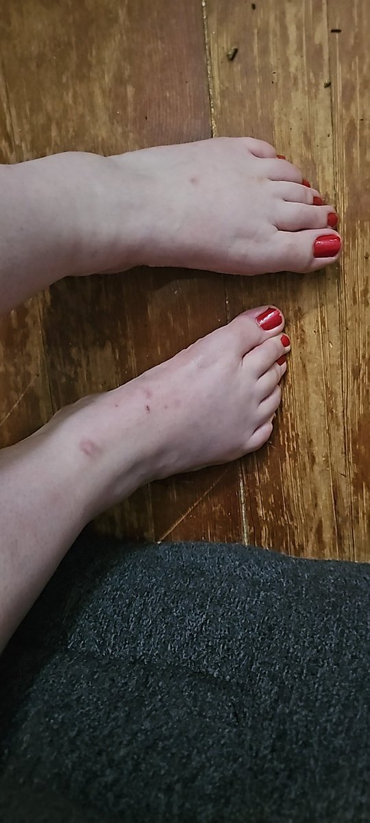FuushFeets's tweet photo. @FeetFinder Always though a bit bruised up atm https://t.co/fR4AcpglQ3