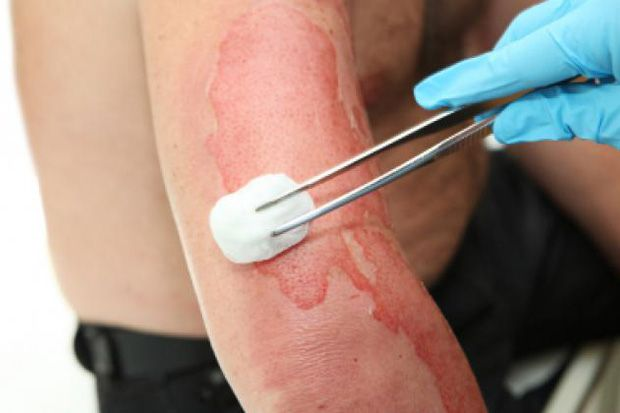 afrkml's tweet image. CATET!
Next time klo kena luka bakar, jangan lakuin:
❌ Dioles pake pasta gigi, tepung, kecap, telor, bensin, dll
❌ Ditutup pake kapas
❌ Ditempelin es batu
❌ Gelembungnya dipecahin
❌ Dikasih serbuk kopi
❌ Disiram pake alkohol

Ada yang tahu alasannya? Gmn cara yg bener? 😆