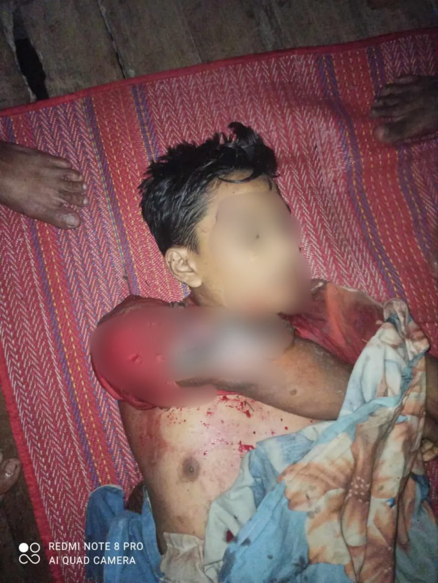 nslwin's tweet photo. On July 10, 2024, at around 10:30 PM, the Arakan Army (AA) fired at least 11 artillery shells towards Rohingya villages in Maungdaw Township. Two young Rohingya men in their early 20s were killed on the spot in Fezi and Cina Fatti villages, and several others sustained minor injuries.