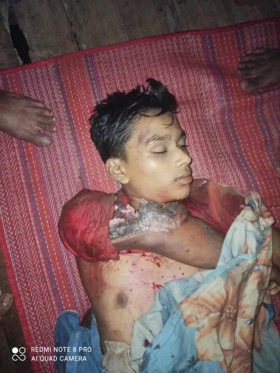 mgsawmyint's tweet photo. At around 10:30 PM on July 10, 2024, AA fired a minimum of 11 #artillery shells at #Rohingya villages in #Maungdaw Township. This attack resulted in the immediate #death of two young Rohingya men in their early 20s in Feyazi villages, and left several others with minor #injuries. https://t.co/NapeHnRXAq