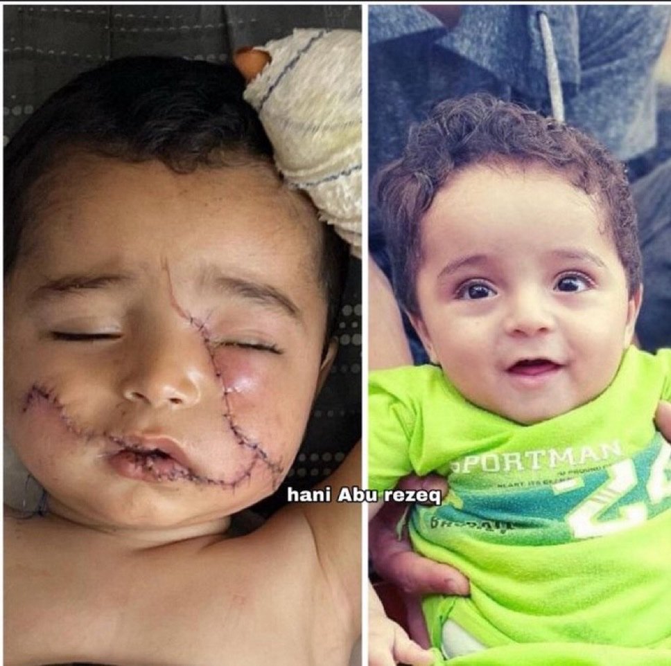 اگر آپ فلسطین نہیں جاسکتے تو آپ میڈیا پر جنگ لڑیں اور آواز اٹھائیں