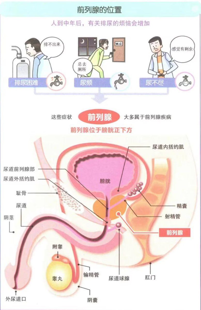 ingridomm's tweet photo. 前列腺，男人健康的生命线！
真正的男人，可以倒在前线上，决不能倒在前列腺上！

前列腺高发人群：生活不规律者、久坐一族、憋尿一族、骑车一族、经常吸烟饮酒者；

前列腺常见病证：有尿频、尿急、尿痛、尿不净、腰腿酸痛、阳痿、早泄漏、性功能障碍等。 https://t.co/rwVQPcr5mT