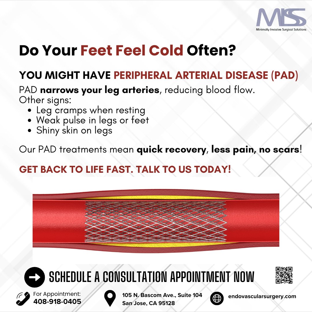 MalianPadidarMd's tweet image. Cold feet often? Get back to living with our non-invasive treatments, today!

📞 (408) 918-0405 
🔗arashpadidar.com/pad-l-peripher…

#PAD #CirculationMatters #WalkWithoutPain #BetterBloodFlow #NonSurgicalSolutions #FastRecovery #EndovascularTherapy #HealthyLifestyle #MISS #SanJose