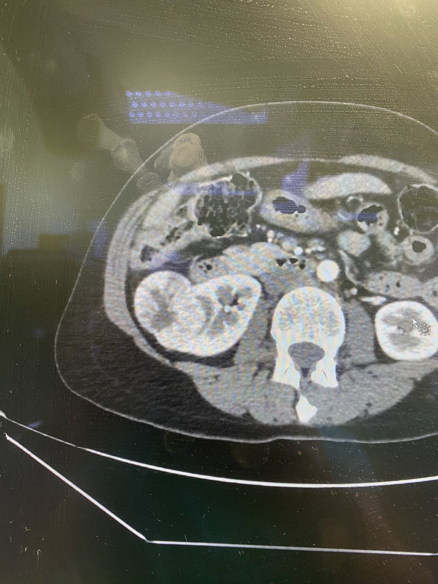 Franco Gaboardi tweet media