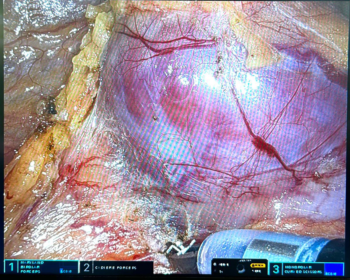 Franco Gaboardi tweet media