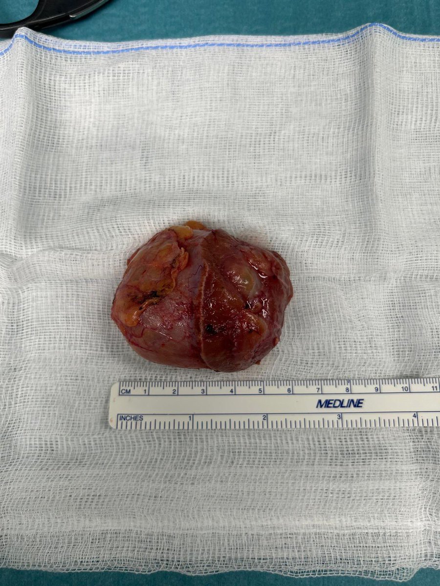 Franco Gaboardi tweet media