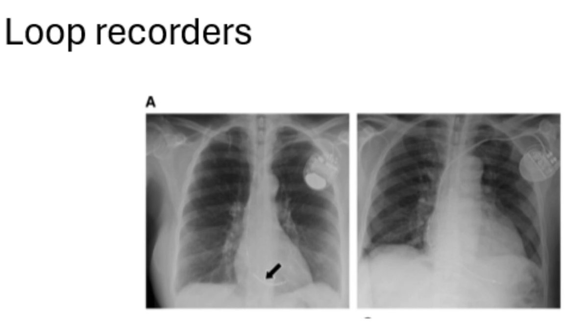 <a href="/ElaineWanMD/">Elaine Wan</a> <a href="/AHAScience/">AHA Science</a> <a href="/CircAHA/">Circulation</a> <a href="/ajrogers_md/">A.J. Rogers</a> <a href="/DJ_Lakkireddy/">DJ Lakkireddy</a> <a href="/AndreaRussoEP/">Andrea Russo</a> <a href="/DrMiguelLeal/">Miguel A Leal</a> O-u-t-s-t-a-n-d-i-n-g! Many thanks for this important work and #AHPs #Inclusion #Diversity #Recognition #EPeeps #HRS #HRX