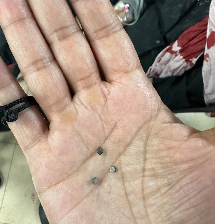 QudsNen's tweet photo. According to The Guardian, citing foreign surgeons who worked in Gaza, Israeli weapons designed to disperse high levels of shrapnel are inflicting severe injuries on civilians, particularly children.

The weapons, used in densely populated civilian areas, include missiles and shells packed with additional metal fragments intended to maximize harm.

Volunteer doctors at Gaza hospitals report that a significant portion of their surgeries involve children struck by tiny shrapnel pieces that cause extensive internal damage despite leaving nearly imperceptible entry wounds. Amnesty International has criticized these weapons for their apparent intent to cause maximum casualties.

Feroze Sidhwa, a trauma surgeon from California who worked at a hospital in southern Gaza, described treating numerous young children with injuries from these small but devastating shrapnel pieces: "About half of the injuries I treated were in young kids. The splinter injuries were minuscule—much smaller than anything I’ve encountered before—but they caused extensive internal damage."