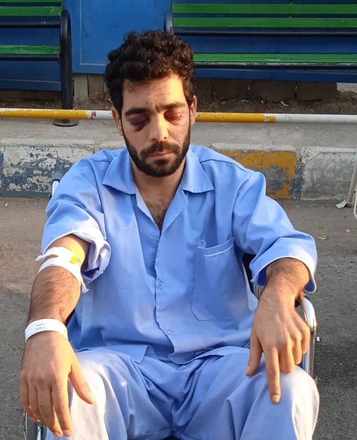 corrrdeliiiaaa's tweet photo. ”این همان کوچه بن بست هست که چهار دفعه با اسلحه به من شلیک کردن و الان سر همون کوچه دارن عزاداری میکنن.
همون جایی که چشمای منو گرفتن.“
/استوری علی طاحونه از آسیب دیدگان چشمی اعتراضات ۱۴۰۱ https://t.co/MQN0hPt4Nm