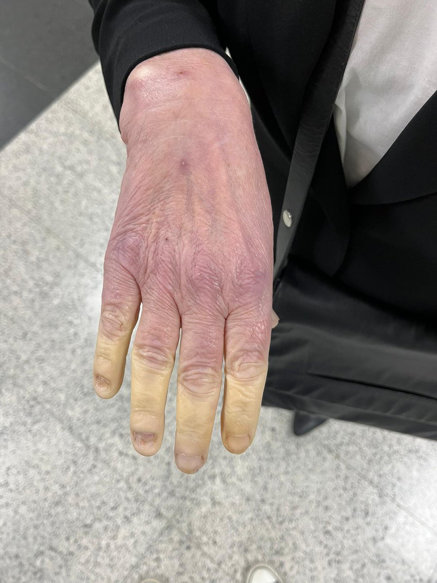 Alvaro Hermida tweet media