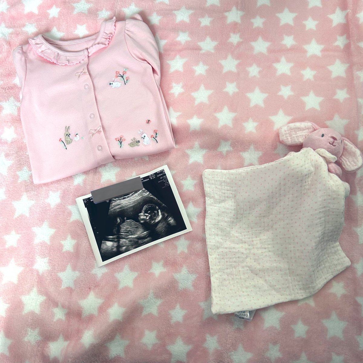 cosyfaerie_'s tweet photo. We found out our babies gender today and it’s pink skies ahead because our little lady is on her way! 🩷 https://t.co/tdburJ07Su