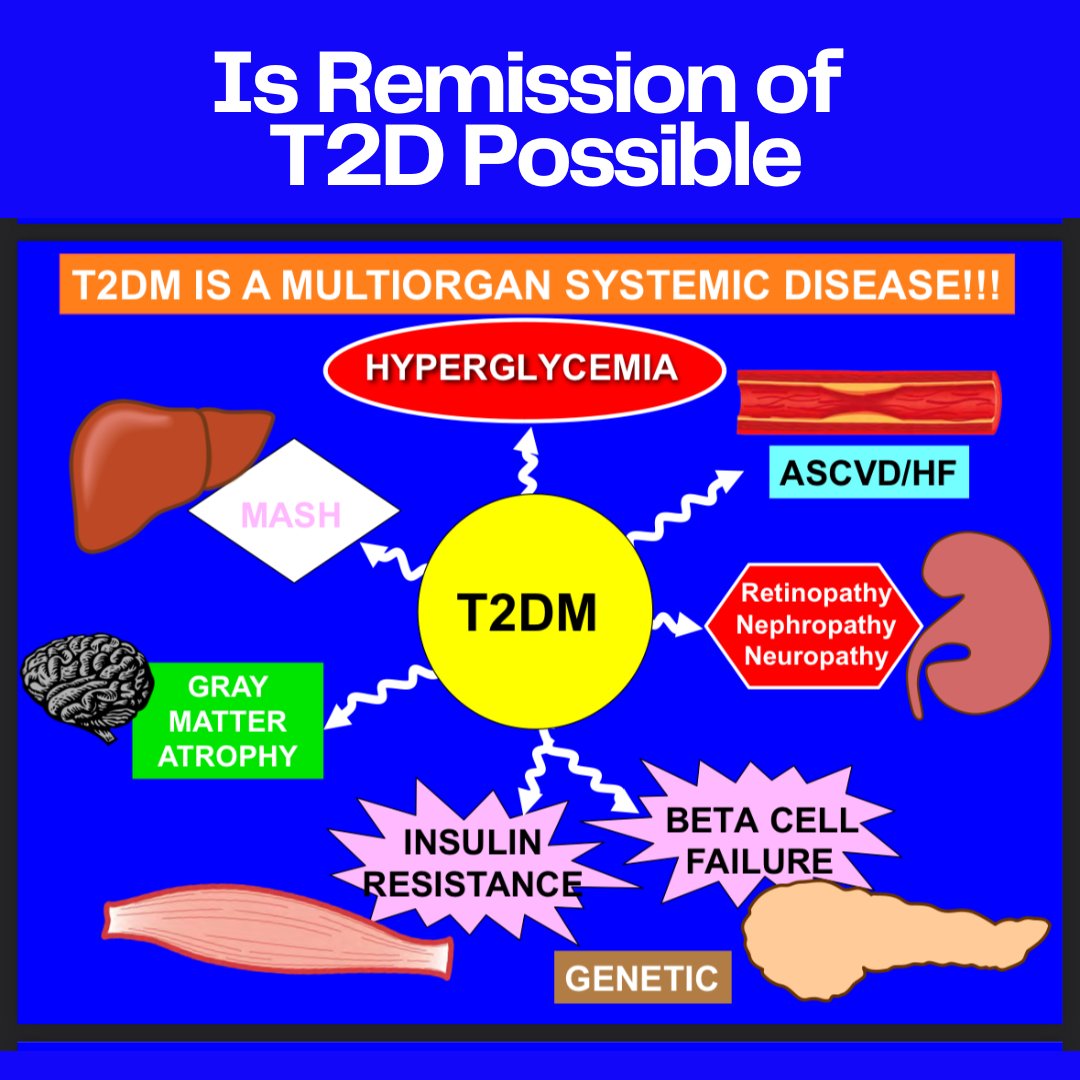 ATDCconference's tweet photo. Thank you for attending Keynote 3: Is Remission of T2D Possible by Ralph DeFronzo, MD. Attendees, you can download the slides in the cvent event app! #ATDC2024 #ATDCconference https://t.co/yRMJszZuK6