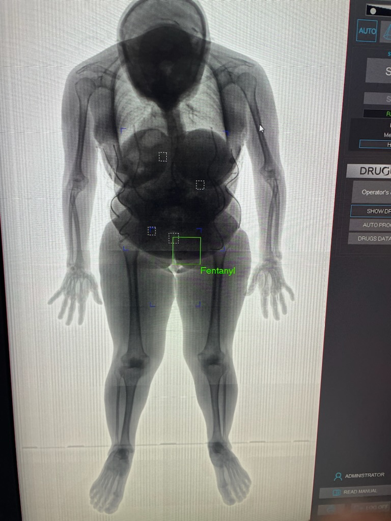 It's not easy to spot. But, there's something here that does not belong.

On July 3rd, a female was arrested and brought to the Walton County Jail for possession of a controlled substance. Upon intake, the inmate was scanned using our new digital body scanner equipped with
