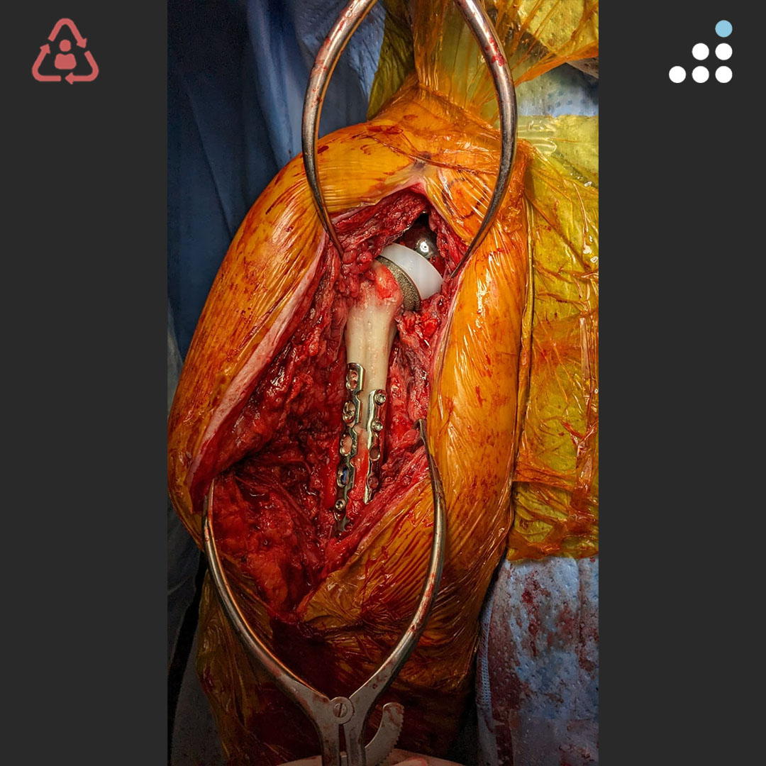 Orthobullets tweet media