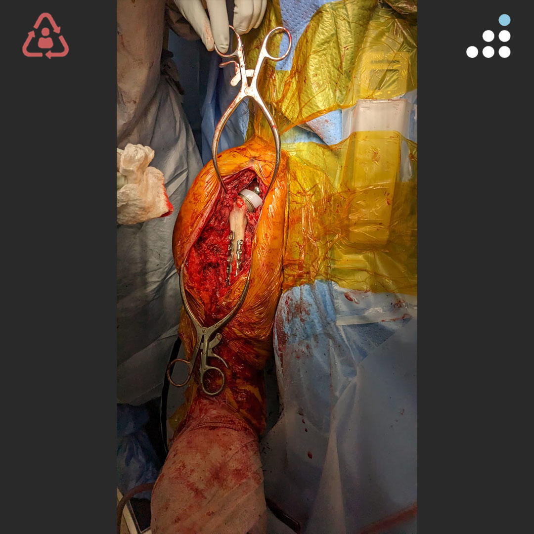 Orthobullets tweet media