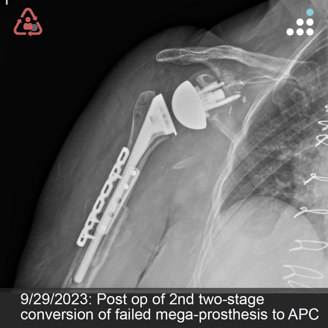 Orthobullets tweet media