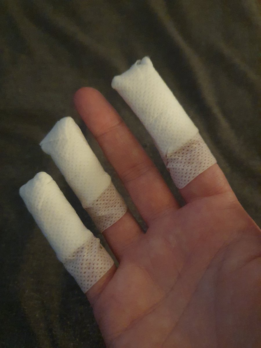 fivebyfive86's tweet image. So apparently Marigolds don't protect from chemical burns. Who knew 🤷‍♀️