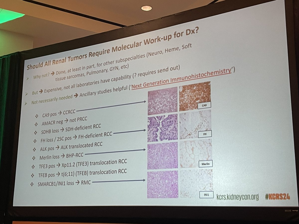 neerajaiims's tweet photo. Surgical Pathology Toolbox and Technological Advances to Solve Kidney Cancer Problems👇Excellent talk by @MichelleDunno17 @BrighamWomens on the pathology diagnosis of RCC variants👇#kidneycancer #KCRS24 @kidneycan Excellent job by chairs @drmehrarohit @PayalKapur5 @DrChoueiri https://t.co/uJGqwfeNlx