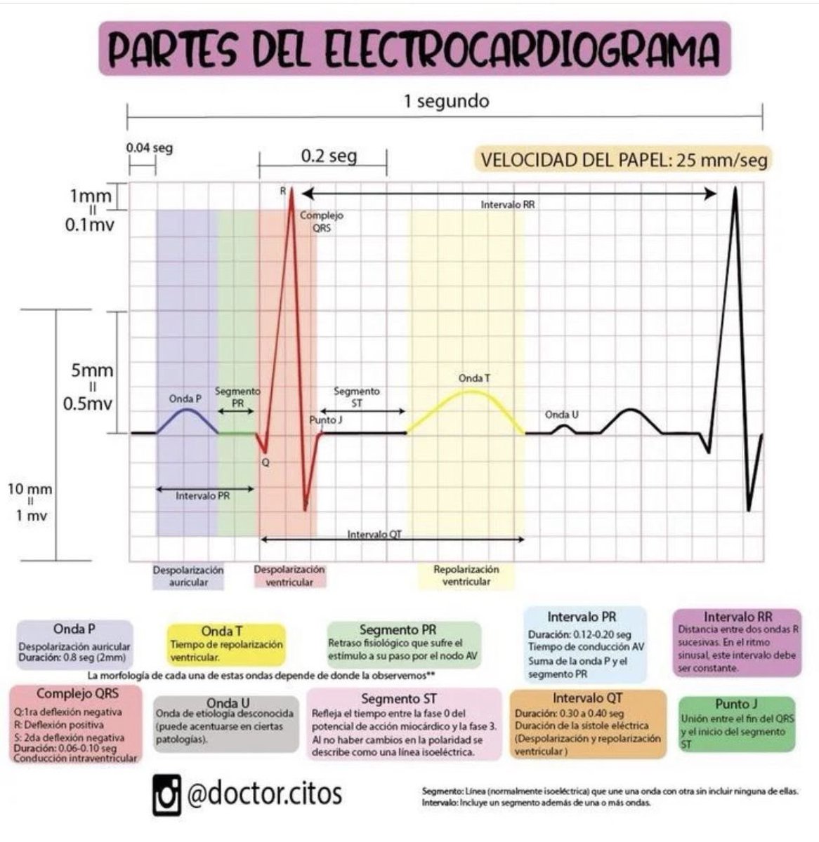 Parte del EKG: