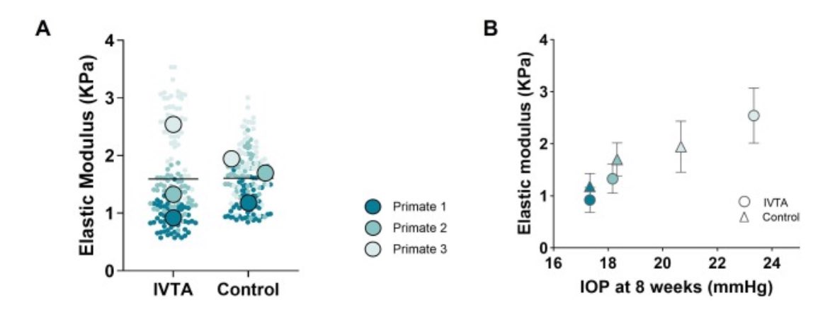 SaraThomasy's tweet photo. How do IVT steroids affect๐ TM biomechanics, proteome & miR transcriptome? @ucdavisvetmed #ophthalmology resident Sangwan Park leads a great COVSL team and VSTP student Raneesh Ramarapu gets his #firstpub! https://t.co/N5SGmNiS24 @VijaykrishnaRag @bcleonard @ucd_eyecenter https://t.co/RilL0nLvBL
