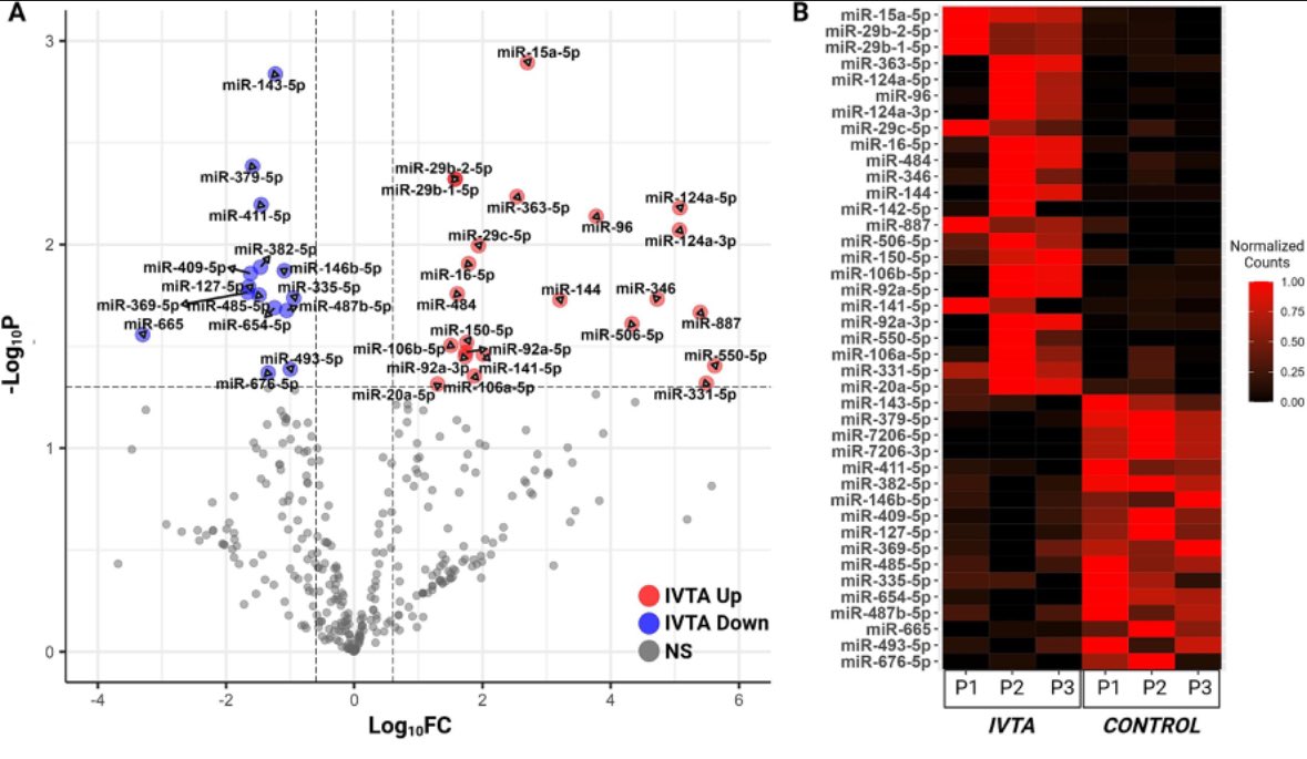 SaraThomasy's tweet photo. How do IVT steroids affect๐ TM biomechanics, proteome & miR transcriptome? @ucdavisvetmed #ophthalmology resident Sangwan Park leads a great COVSL team and VSTP student Raneesh Ramarapu gets his #firstpub! https://t.co/N5SGmNiS24 @VijaykrishnaRag @bcleonard @ucd_eyecenter https://t.co/RilL0nLvBL