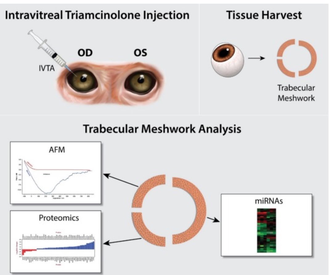 SaraThomasy's tweet photo. How do IVT steroids affect๐ TM biomechanics, proteome & miR transcriptome? @ucdavisvetmed #ophthalmology resident Sangwan Park leads a great COVSL team and VSTP student Raneesh Ramarapu gets his #firstpub! https://t.co/N5SGmNiS24 @VijaykrishnaRag @bcleonard @ucd_eyecenter https://t.co/RilL0nLvBL