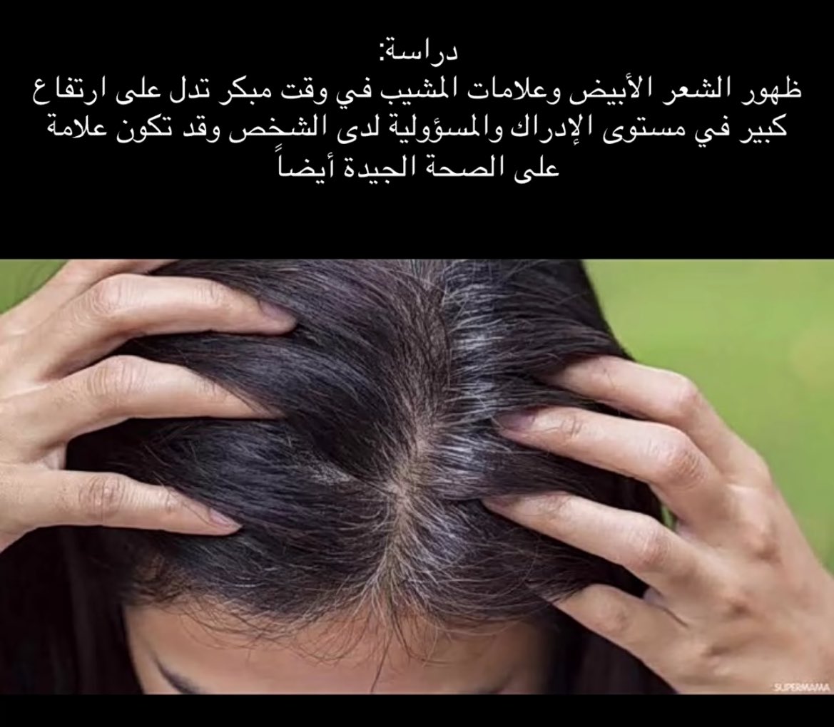lenixx_1's tweet photo. اييييييي https://t.co/kgl8T4cVfm