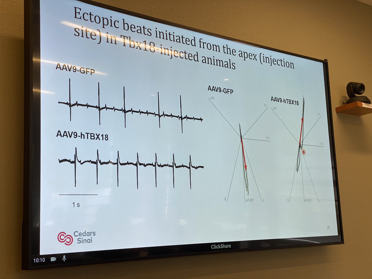 MarbanLab's tweet photo. Provocative #lab #meeting by postdoc Rodrigo dos Santos on #biopacemaker induced by #AAV Tbx18. Notable efficacy in supporting heart rate during exercise. #EKG #vectors c/w impulse initiation at the LV injection site. Humans next? 
#EPeeps #CardioTwitter https://t.co/LMgRGB2r1L