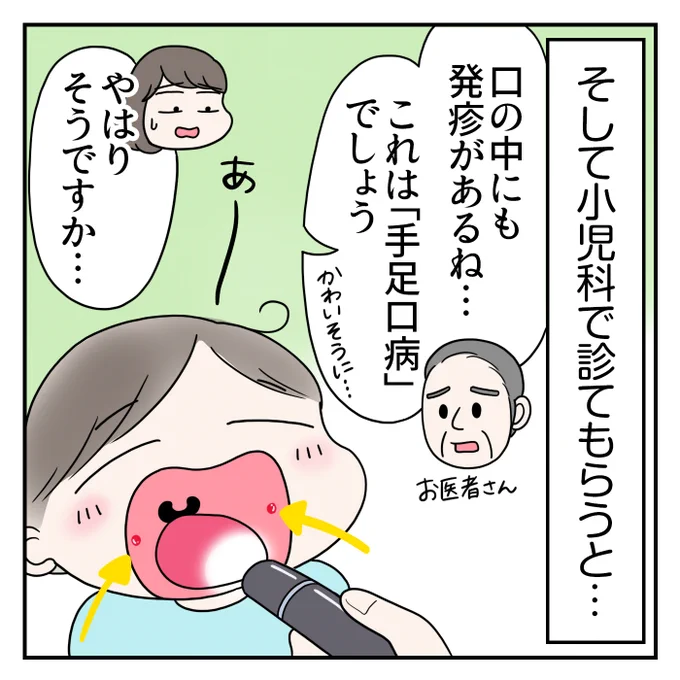 育児絵日記『手足口病にかかりました(軽症でした)』(0/7) 