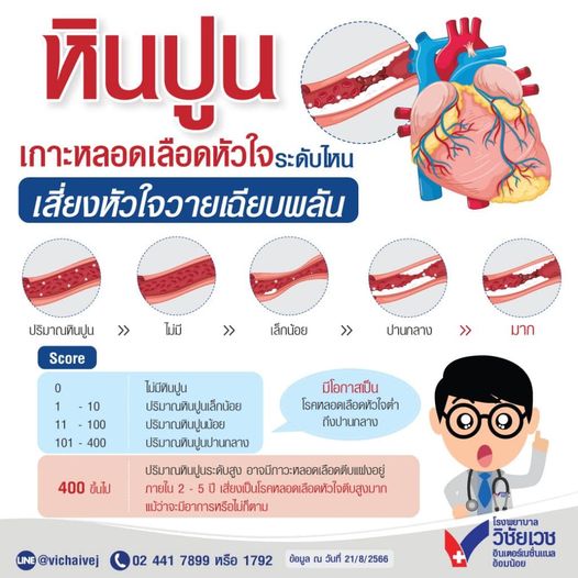 vichaivej's tweet image. #เช็คหัวใจกันเถอะ ❤️#หินปูนเกาะหลอดเลือดหัวใจ ระดับไหน เสี่ยงหัวใจวายเฉียบพลัน‼️
✨รู้ระดับความเสี่ยงได้ด้วยการตรวจ #CTCalciumScore
😍แม่นยำสูง ตรวจง่าย ไม่เจ็บ ใช้เวลาน้อย ปลอดภัย
สอบถามเพิ่มเติม
linktr.ee/vichaivejomnoi
☎️02-441-7899 หรือ 1792
#วิชัยเวชอ้อมน้อย #ตรวจสุขภาพ