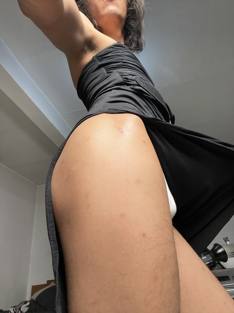SugarBabyFat1's tweet photo. Ya quiero iniciar la transición y ponerme vestidos a gusto sin que mis hombros y mi cara me hagan sentir mal. https://t.co/OXpdsneO9M