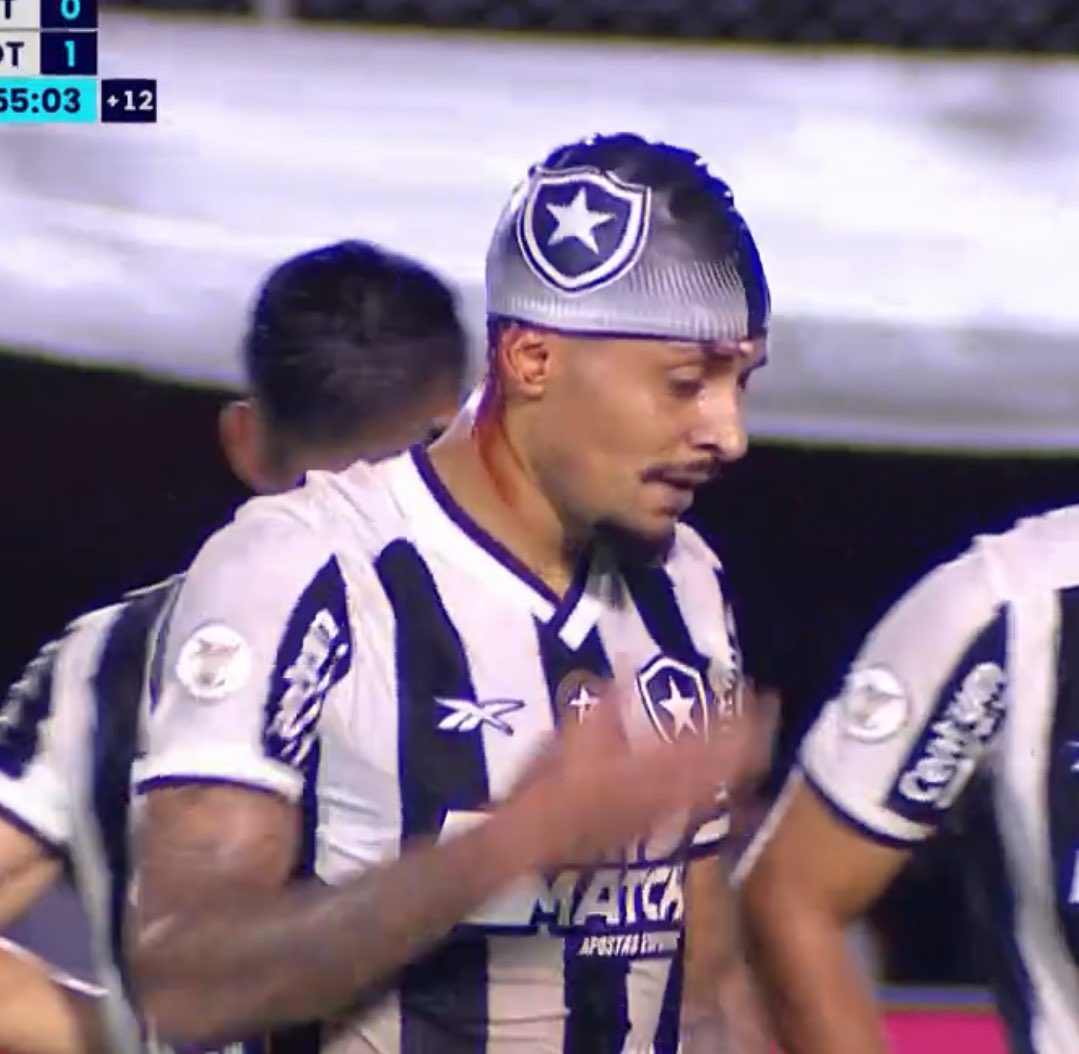 Gregore = pitbull máximo. Todos os lugares do campo. Jogadoraço.

Sofreu o pênalti e deixou TUDO em campo. Inclusive o sangue. 🐶😡