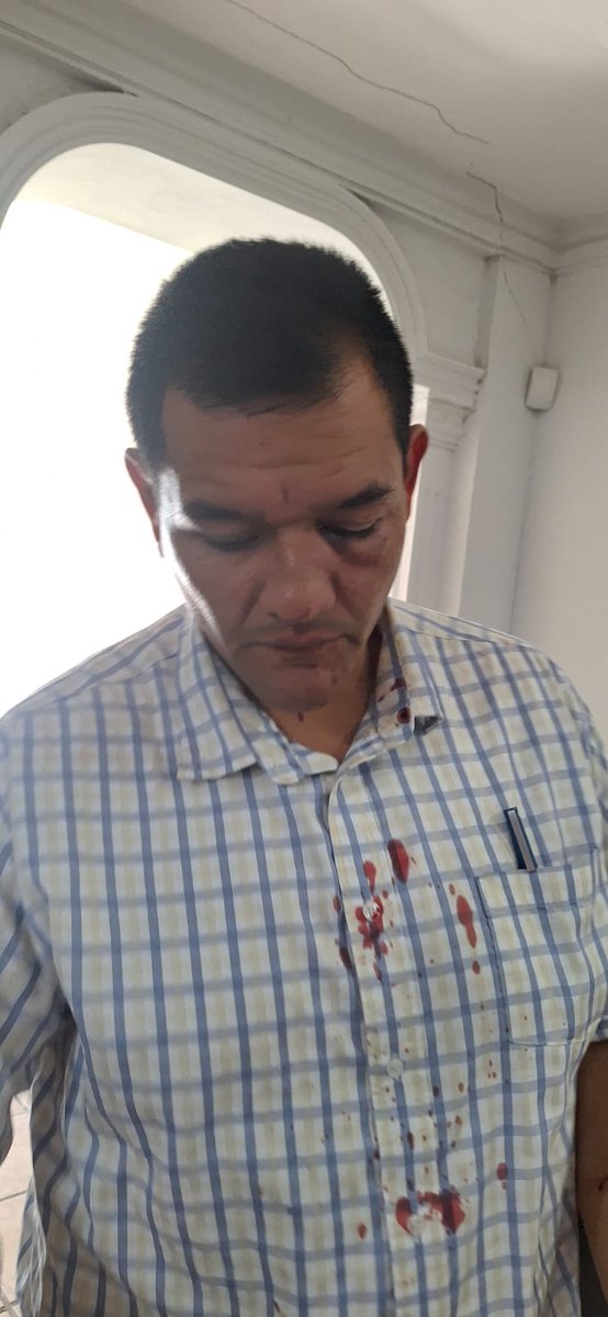 fantasmasuarez's tweet photo. 🚨 ALERTA ATENTADO
-El abogado @LicAlfredoOchoa quien ganó el juicio en @SCJN del ciego despojado de sus ejidos para la construcción del estadio TSM y está a la espera de ejecución de sentencia 
denuncia que sufrió un ATENTADO contra su vida esta tarde en TORREÓN y en video hace responsable a @Irarragorri y pide la protección del presidente @lopezobrador_ y las autoridades @PJCoah 
Abro hilo..👇👇