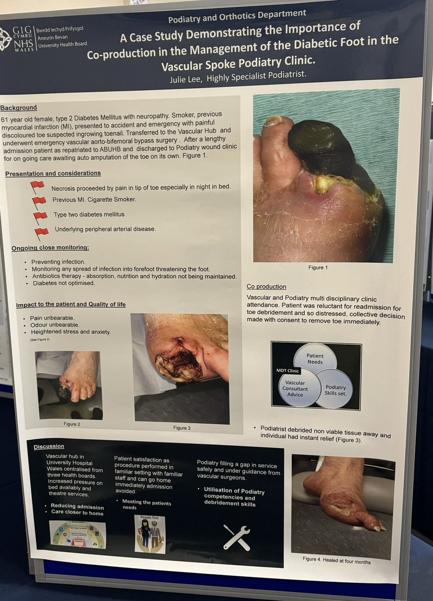 The podiatry and orthotics team , presenting posters at the #ABUHB AHP and healthcare  scientists conference #AB_AHPHCSConf <a href="/GriffithsCarlie/">Carlie Griffiths</a>  <a href="/kateanyawalters/">Kate-Anya Walters</a>  @scottishpanther