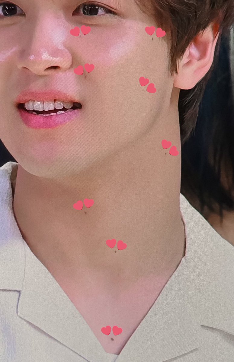kogumahaechan's tweet photo. haechan must’ve been kissed a lot in his past life because he has so many moles on his cheek and neck 🥹🤏🏼 https://t.co/A0ynCuhp5g