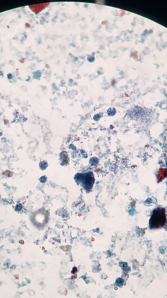 Marc Couturier PhD, D(ABMM) 🕷🦠🔬 tweet media