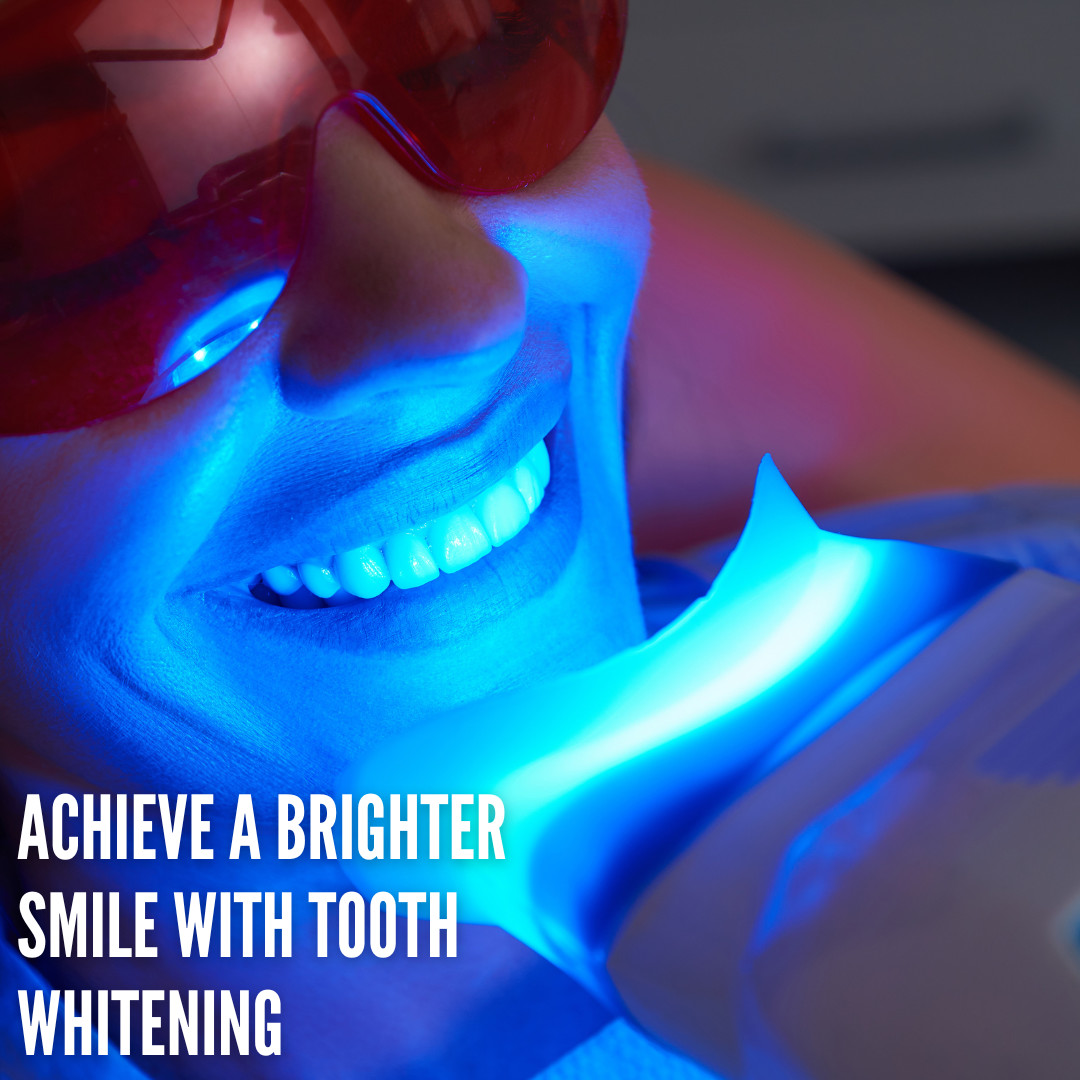 bureau_george's tweet photo. Transform your smile with professional tooth whitening at George Bureau. Brighten your day and your smile.
📞 Call us now: 01473 257414
#ToothWhitening #BrighterSmile #GeorgeBureau #TeethWhitening #OralCare https://t.co/ucuXK9nXGp