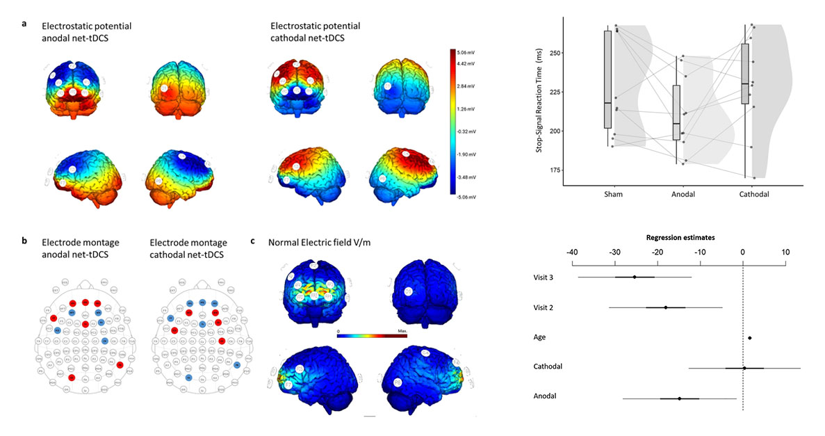 We're thrilled to see <a href="/ruffini/">Giulio Ruffini</a> &amp; <a href="/ne_salvador/">NE_ricardo.salvador</a>  collaborate with researchers on a breakthrough study! 

Check out how they used our #Starstim device &amp; found non-invasive anodal net-tDCS significantly enhanced inhibitory control in individuals with obesity: nature.com/articles/s4159…