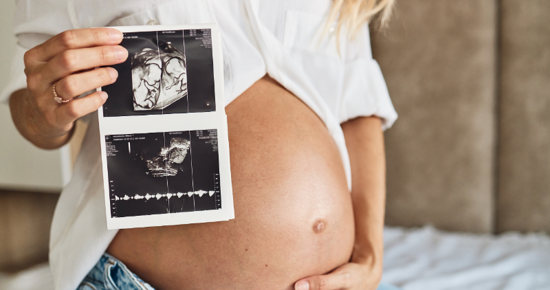 Dr Narina du Plessis, a maternal and foetal medicine specialist at Mediclinic Kloof, shares key insights about pre-natal assessments: mediclinic.link/367ca9  #MaternalHealth